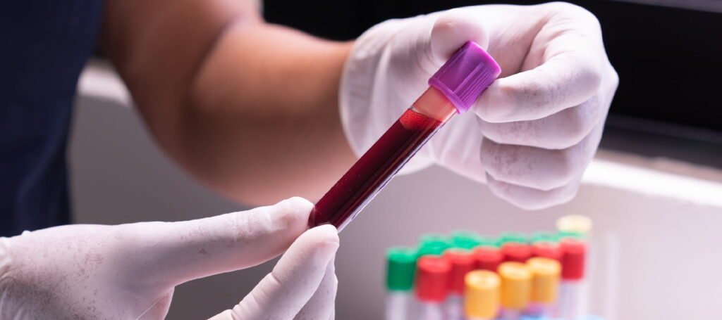 Understanding Common Blood Test Results: A Simple Guide