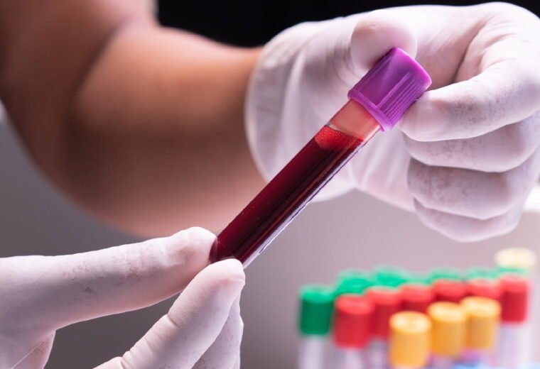 Understanding Common Blood Test Results: A Simple Guide